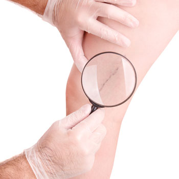 Флебологический кабинет