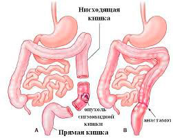 Схема Кишечника Фото