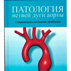 Патология ветвей дуги аорты: современное состояние проблемы