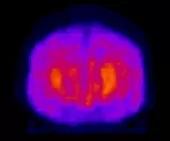 Исследование головного мозга