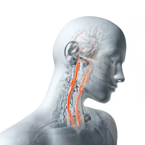 Сосудистая хирургия