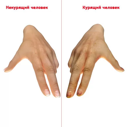 hand.jpg