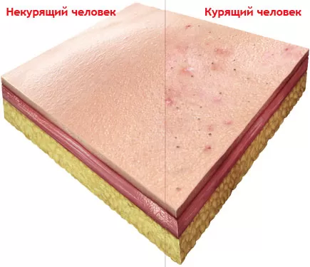 skin_m.jpg