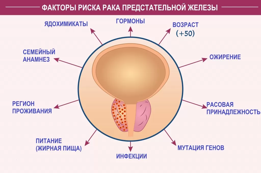 Почему выбирают их: важные причины
