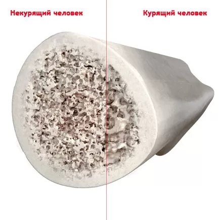 bones.jpg