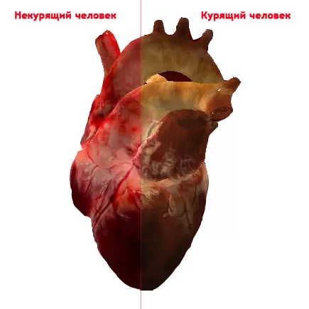heart.jpg