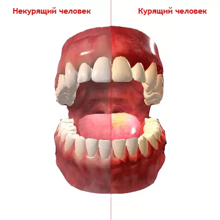 teeth.jpg